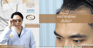 ระหว่างปลูกผมเจ็บไหม