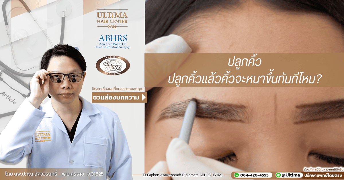 ปลูกคิ้วแล้วคิ้วจะหนาขึ้นทันทีไหม