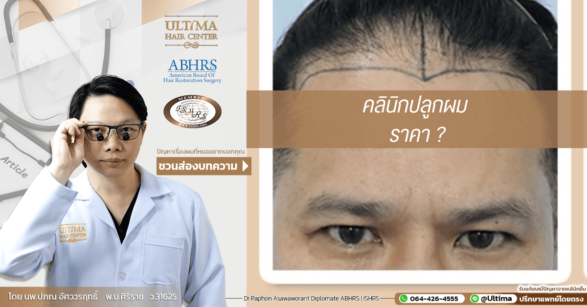 คลินิกปลูกผม ราคา