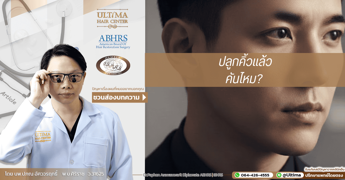 ปลูกคิ้วแล้วคันไหม