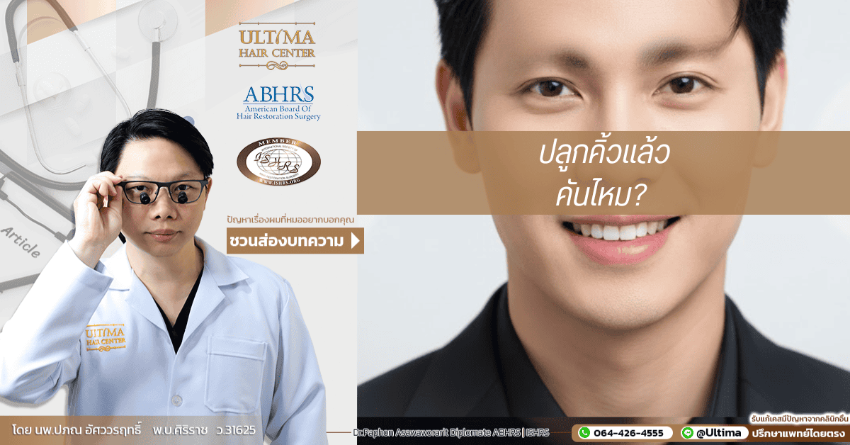 ปลูกคิ้วแล้วขนคุดได้ไหม