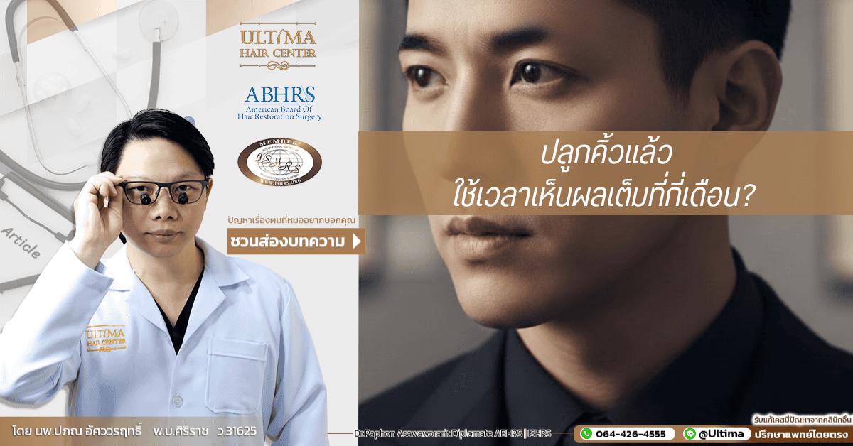 ปลูกคิ้วแล้วใช้เวลาเห็นผลเต็มที่กี่เดือน