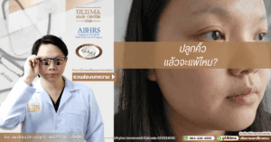 ปลูกคิ้วแล้วจะแพ้ไหม