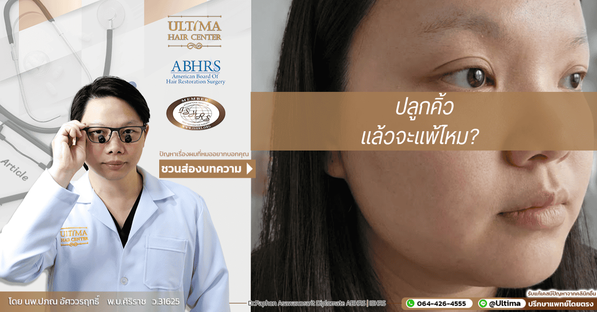 ปลูกคิ้วแล้วจะแพ้ไหม