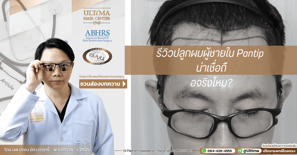 รีวิวปลูกผมผู้ชายใน Pantip น่าเชื่อถือจริงไหม