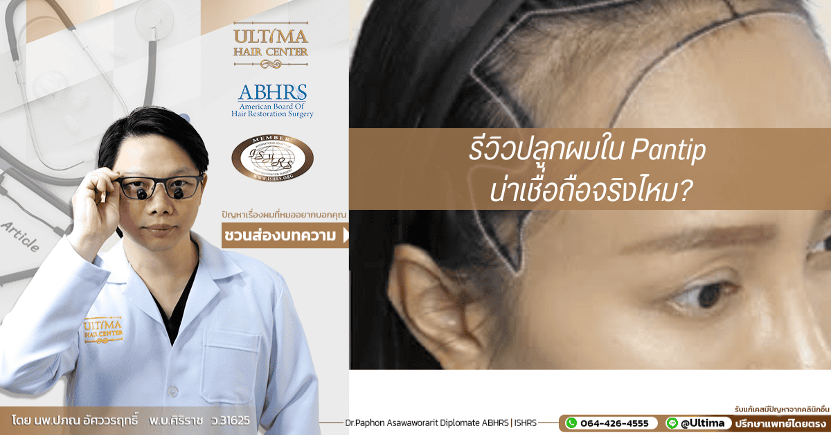 รีวิวปลูกผมใน Pantip น่าเชื่อถือจริงไหม