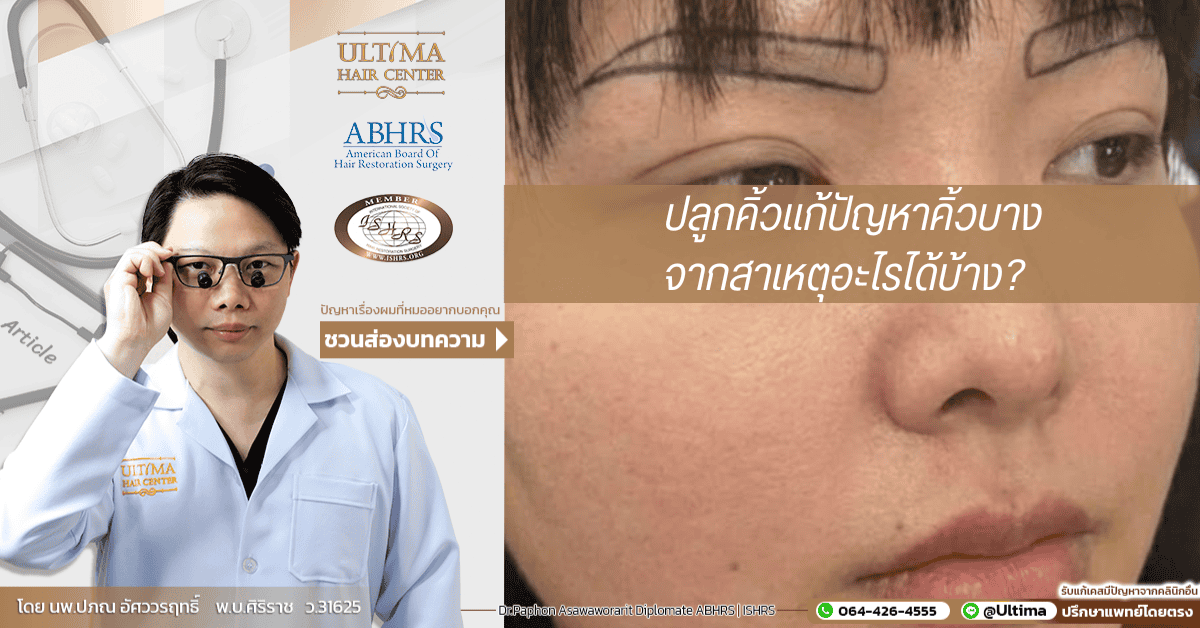 ปลูกคิ้วแก้ปัญหาคิ้วบางจากสาเหตุอะไรได้บ้าง ปลูกคิ้วแก้ปัญหาคิ้วบางจากสาเหตุอะไรได้บ้าง