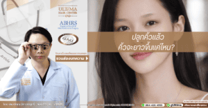 ปลูกคิ้วแล้วคิ้วจะยาวขึ้นแค่ไหน