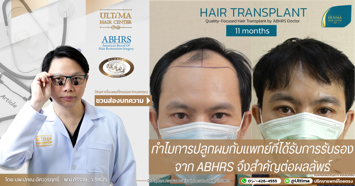 ทำไมการปลูกผมกับแพทย์ที่ได้รับการรับรองจาก ABHRS จึงสำคัญต่อผลลัพธ์ ทำไมการปลูกผมกับแพทย์ที่ได้รับการรับรองจาก ABHRS จึงสำคัญต่อผลลัพธ์