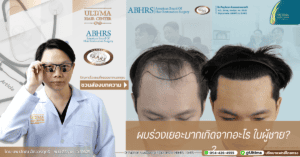 ผมร่วงเยอะมากเกิดจากอะไร ในผู้ชาย