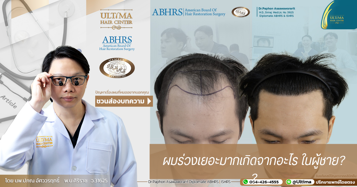 ผมร่วงเยอะมากเกิดจากอะไร ในผู้ชาย ผมร่วงเยอะมากเกิดจากอะไร ในผู้ชาย