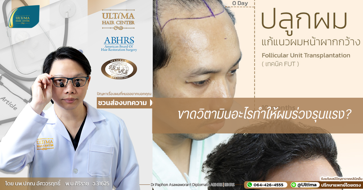 ขาดวิตามินอะไรทำให้ผมร่วงรุนแรง