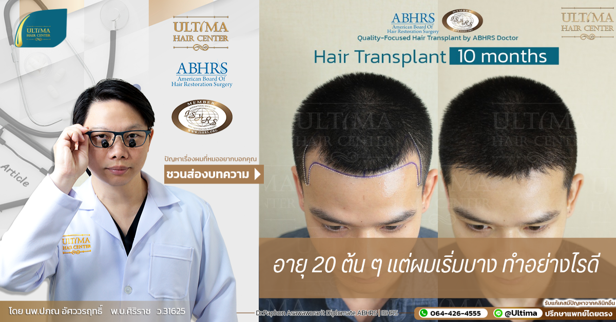 อายุ 20 ต้น ๆ แต่ผมเริ่มบาง ทำอย่างไรดี อายุ 20 ต้น ๆ แต่ผมเริ่มบาง ทำอย่างไรดี