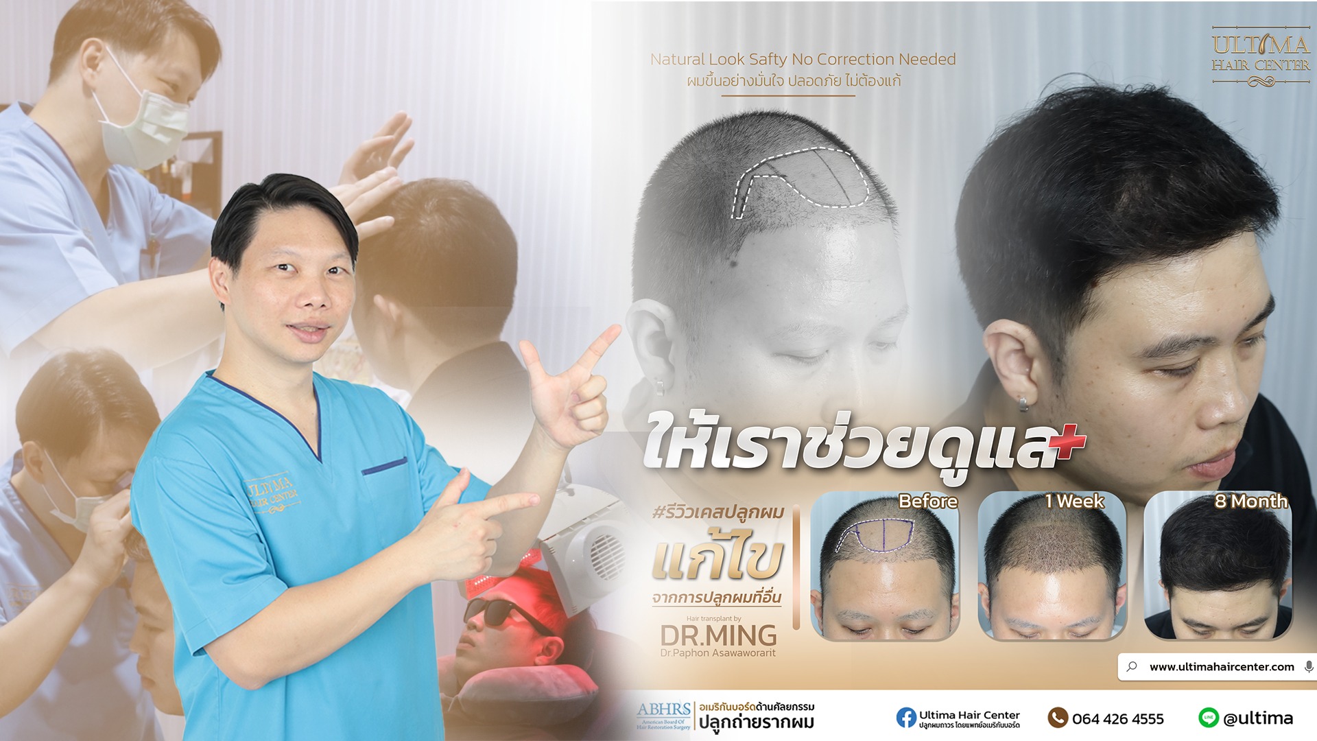 คืนความมั่นใจ บอกลาศีรษะล้าน