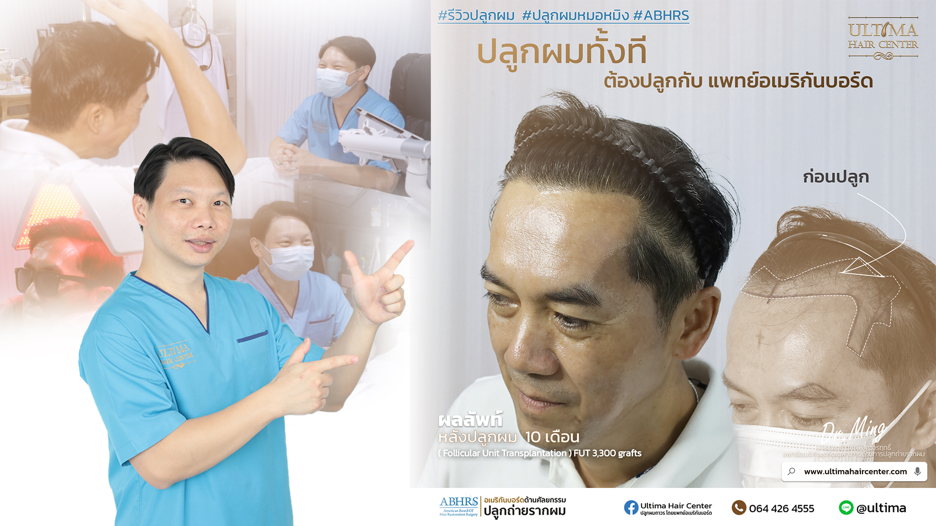 คืนความมั่นใจ บอกลาศีรษะล้าน
