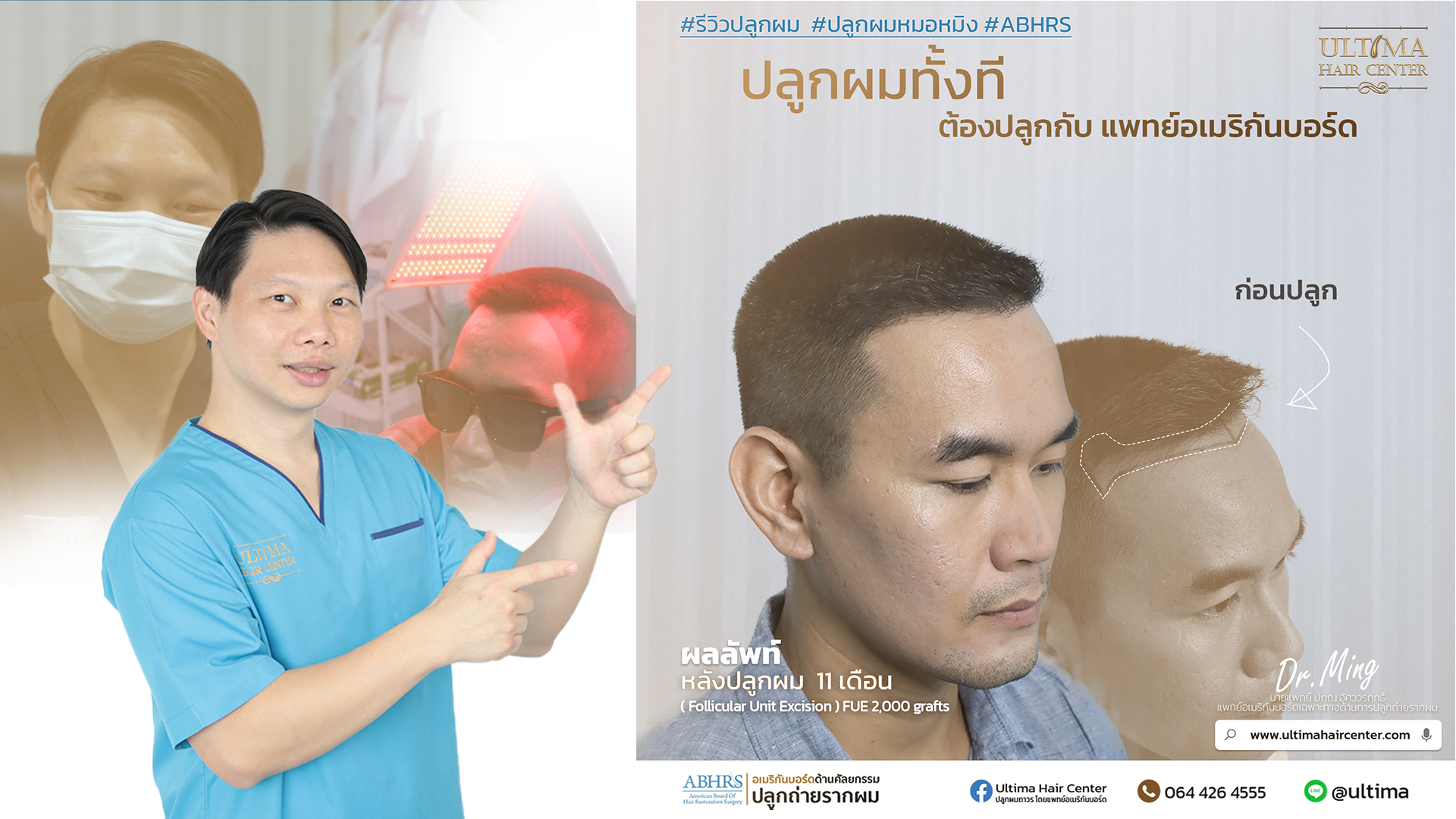 ความแตกต่างของเส้นผมระหว่างชาวเอเชียและชาวยุโรป ความแตกต่างของเส้นผมระหว่างชาวเอเชียและชาวยุโรป