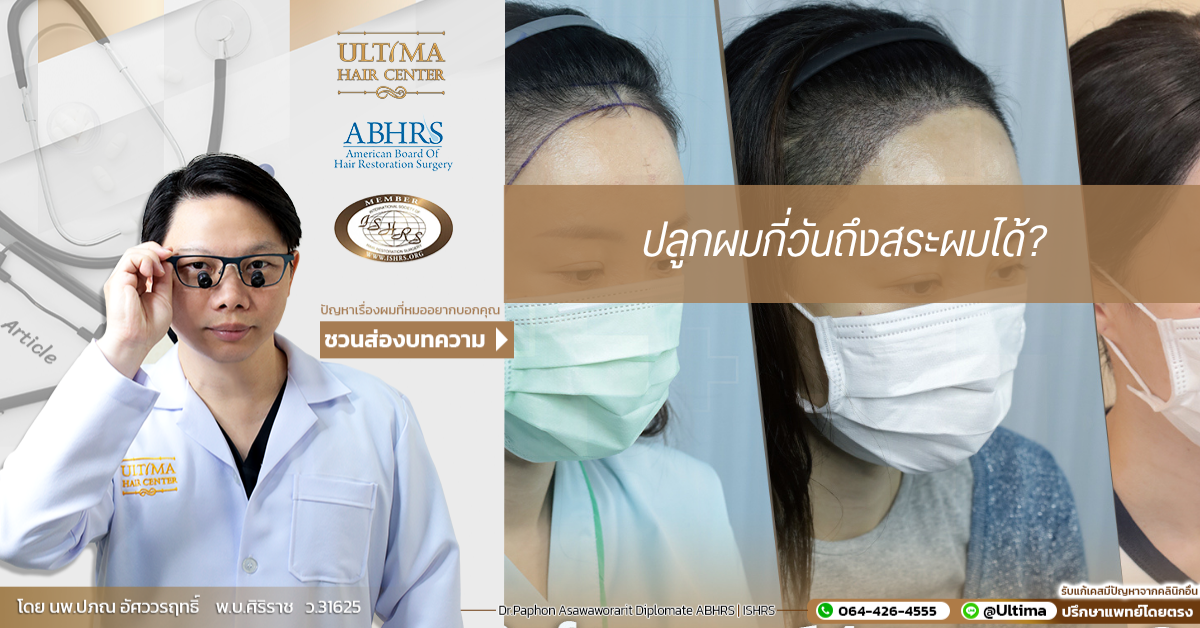 ปลูกผมกี่วันถึงสระผมได้ ปลูกผมกี่วันถึงสระผมได้