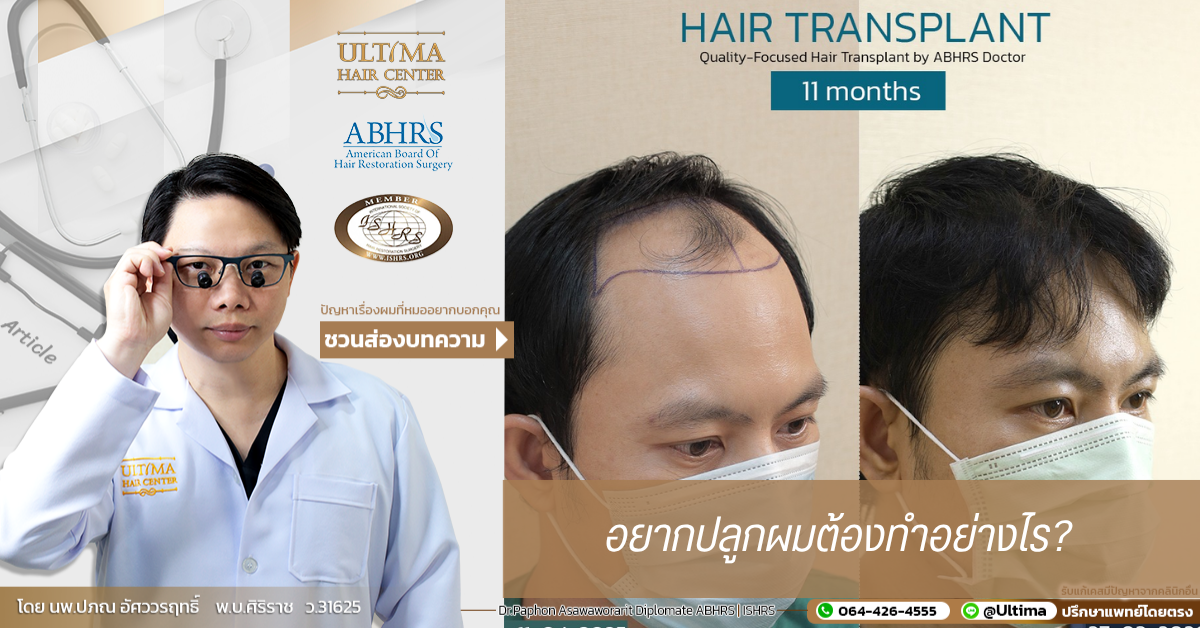 อยากปลูกผมต้องทำอย่างไร? 