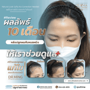 ปลูกผม
