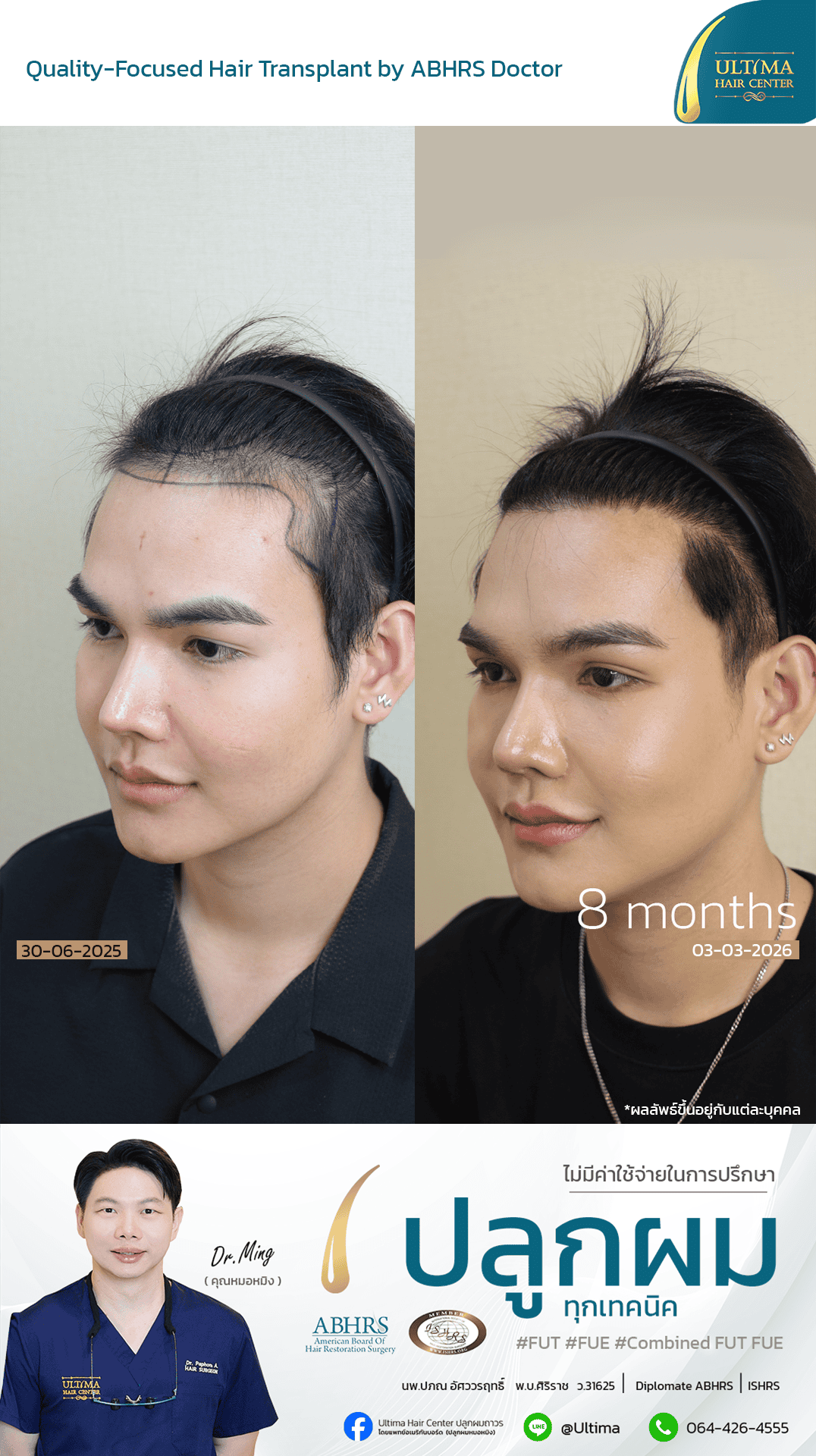 ปลูกผมได้ประโยชน์อย่างไร