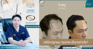 คลินิกปลูกผม กรุงเทพ เลือกอย่างไร