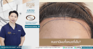 คนเรามีผมทั้งหมดกี่เส้น