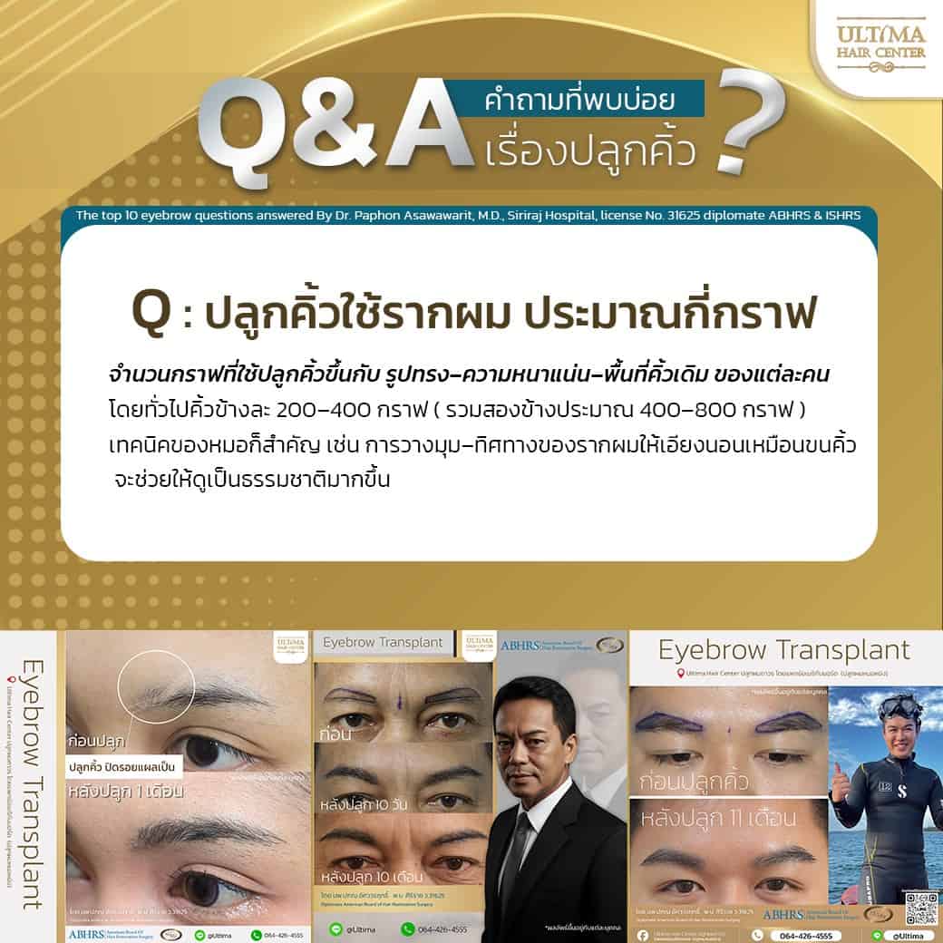 ปลูกคิ้วคืออะไร