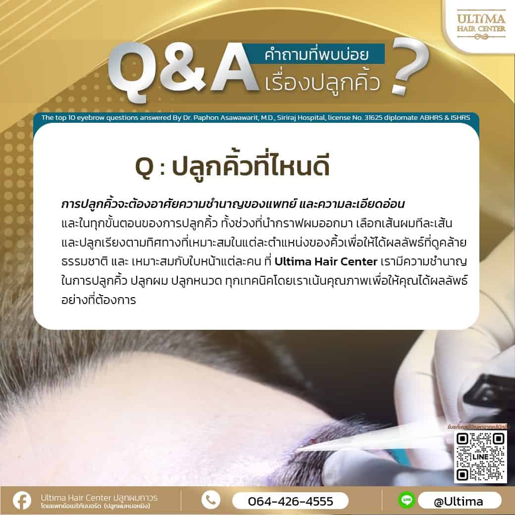 ปลูกคิ้วคืออะไร
