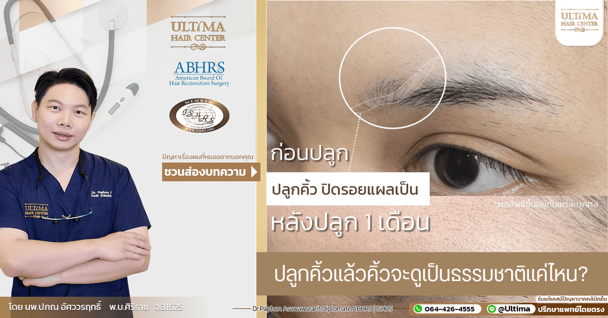 ปลูกคิ้วแล้วสามารถโกนได้ไหม
