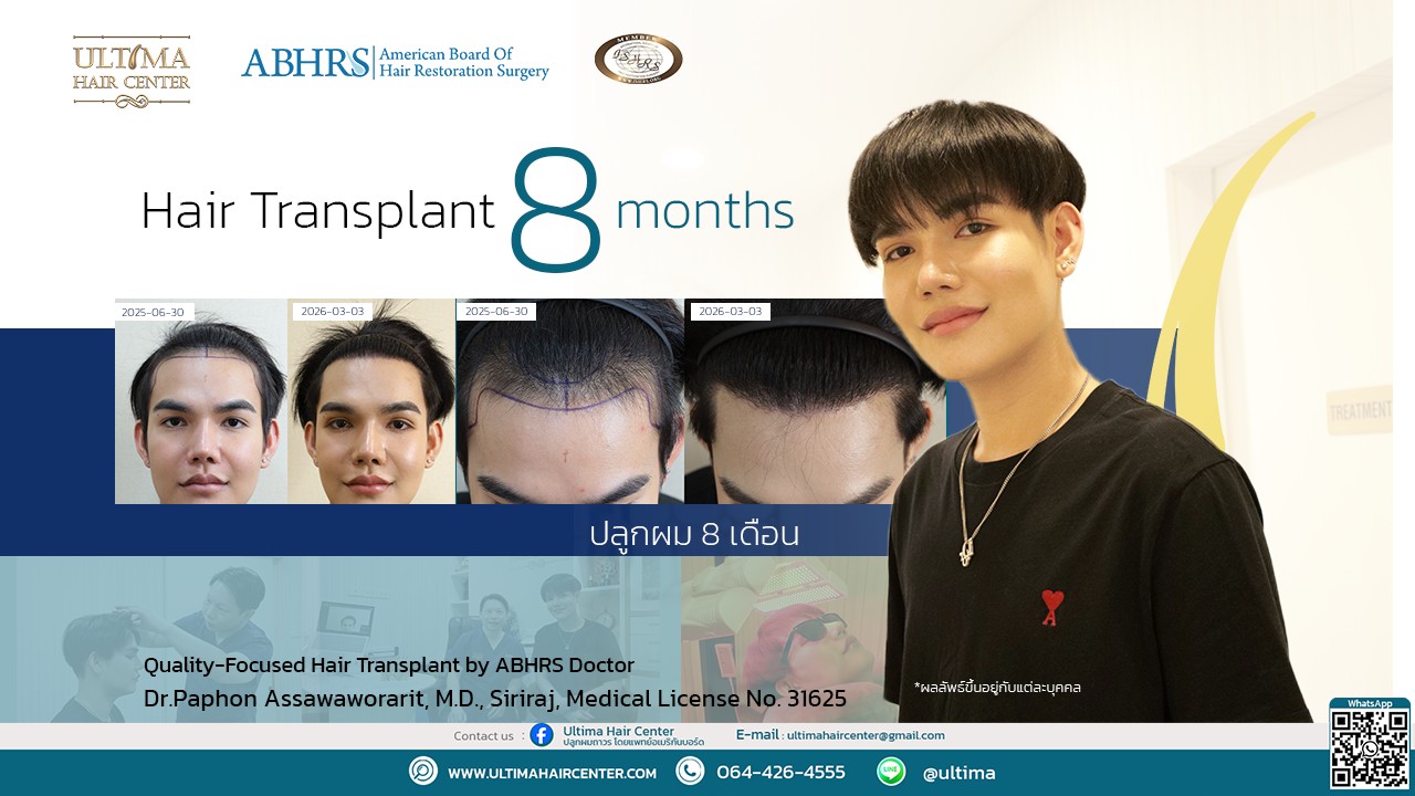 แพทย์ปลูกผม ABHRS กรุงเทพ คืออะไร
