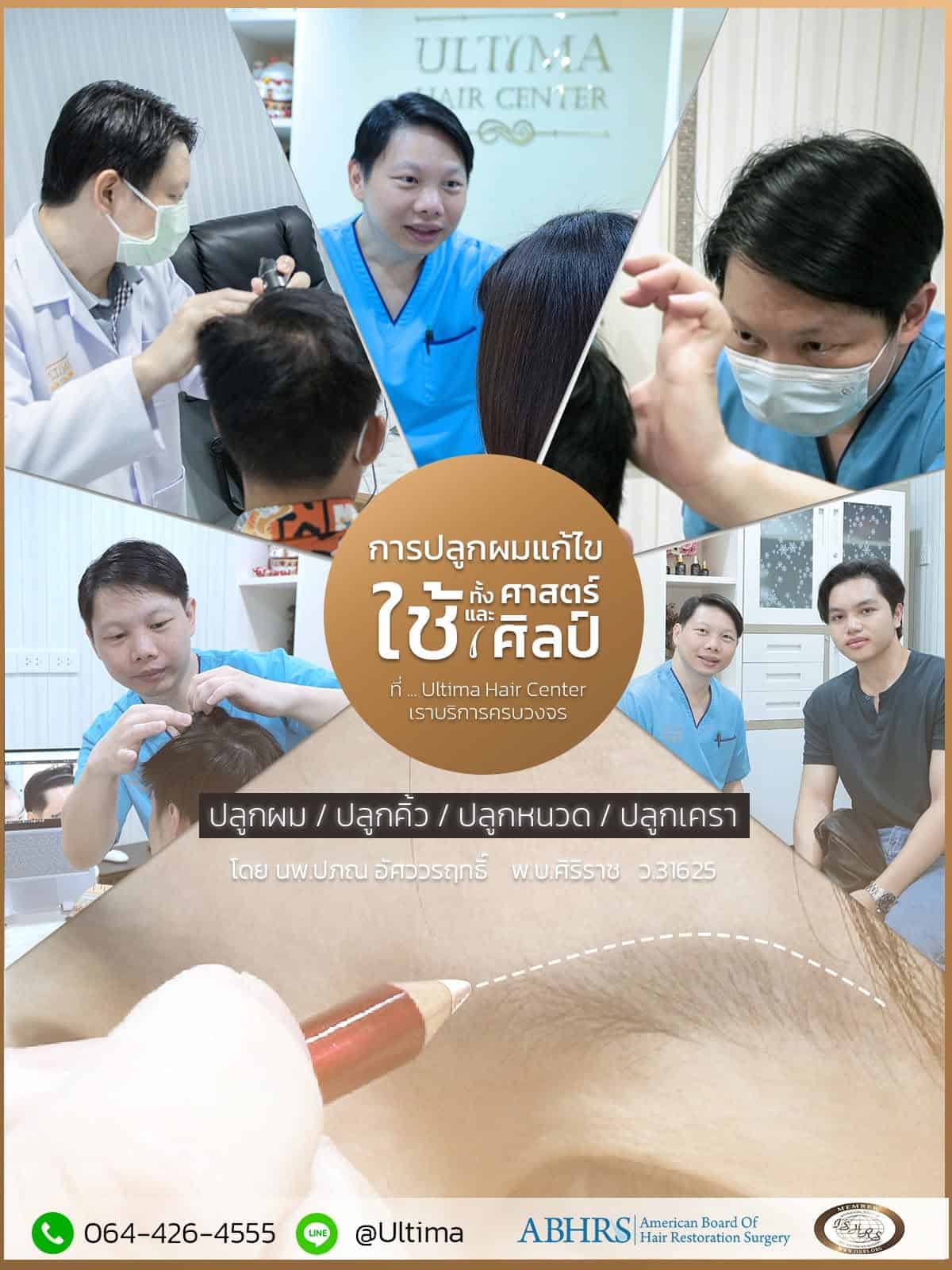 ปลูกผมรอบสอง