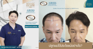 ปลูกผมได้ประโยชน์อย่างไร