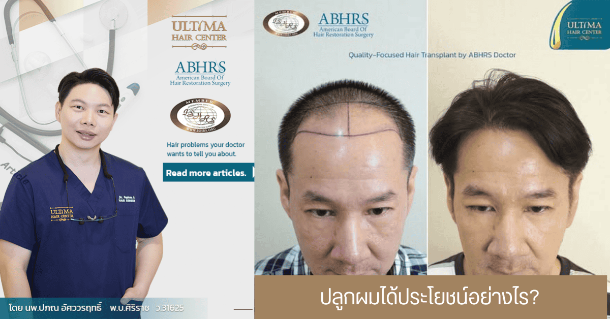 ปลูกผมได้ประโยชน์อย่างไร