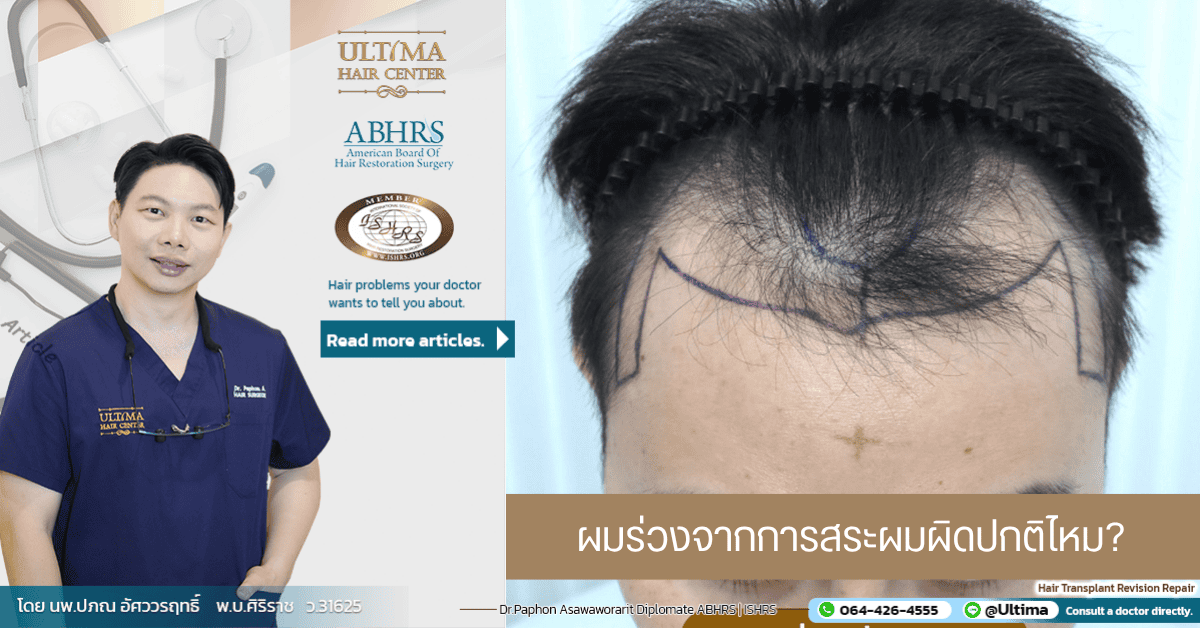ผมร่วงจากการสระผมผิดปกติไหม
