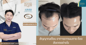 สัญญาณเตือน อาการรากผมตาย ต้องสังเกตอย่างไร
